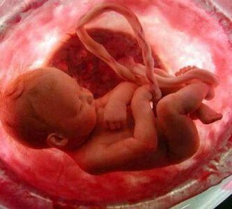 aborto-concepción