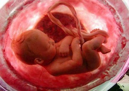 aborto-concepción